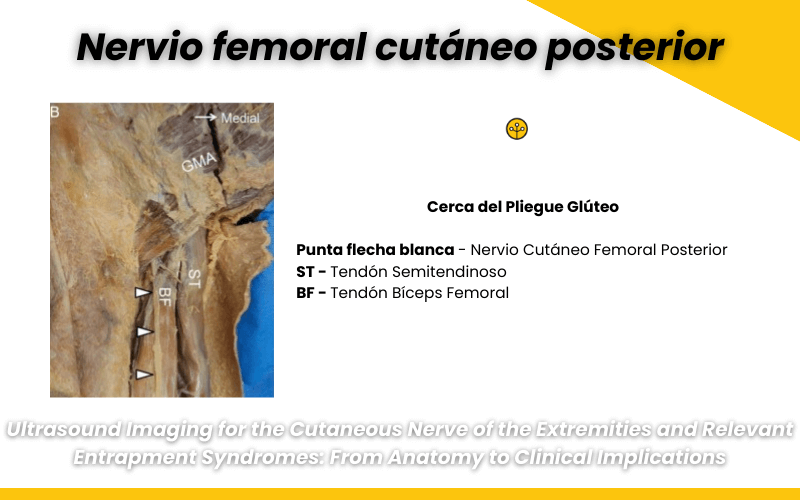 1. Nervio femoral cutaneo posterior ecografia tempo formacion.png
